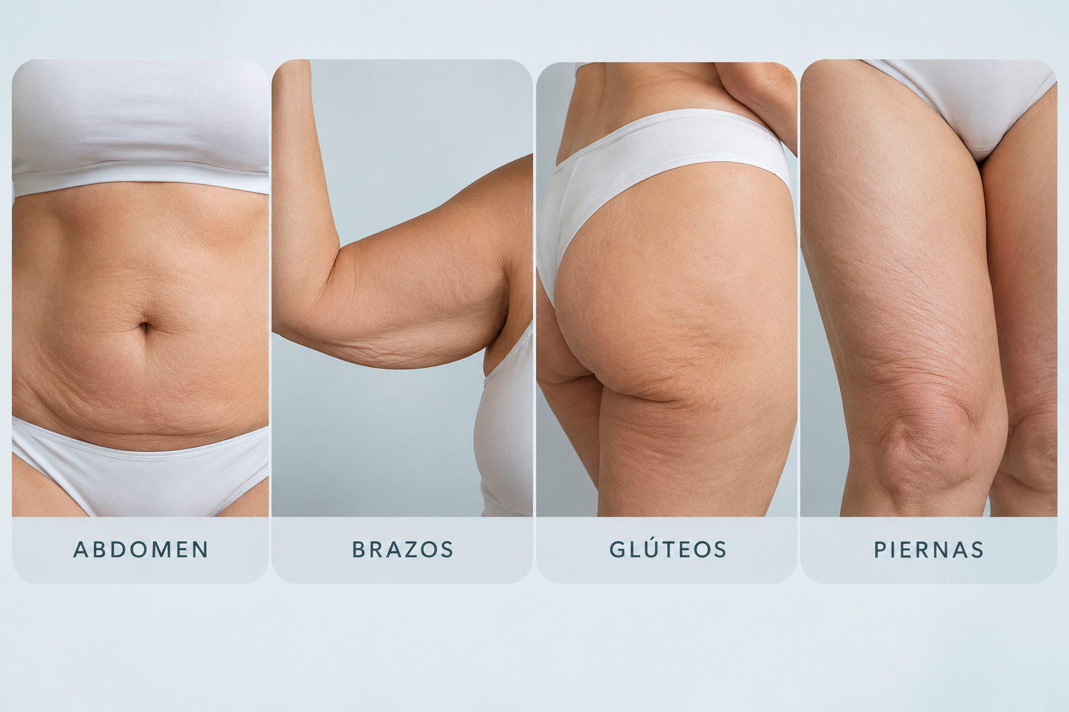 Flacidez en abdomen, brazos, glúteos y piernas